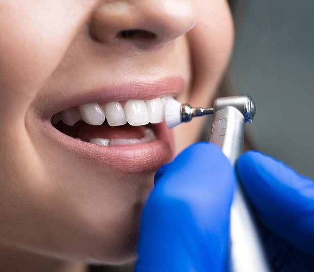 A closeup of a professional dental cleaning
