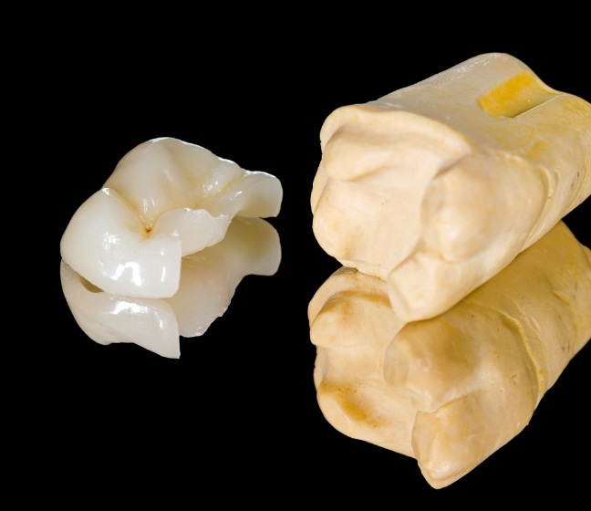 Model tooth with metal free dental restoration