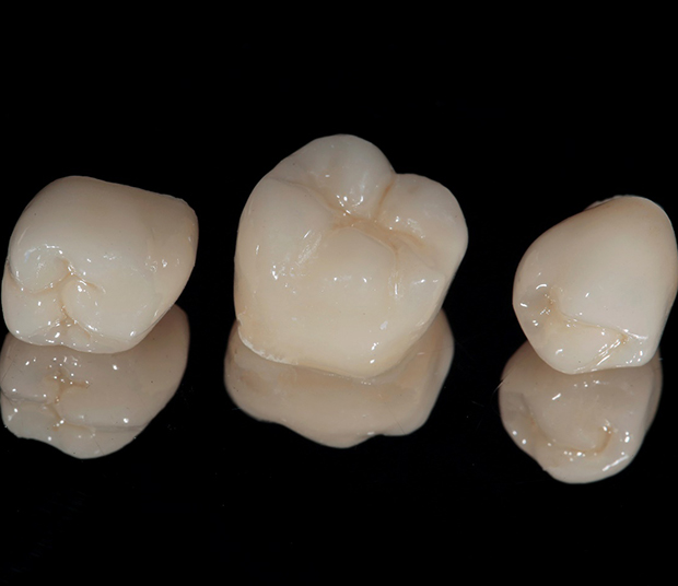 Three dental crowns lying on a table