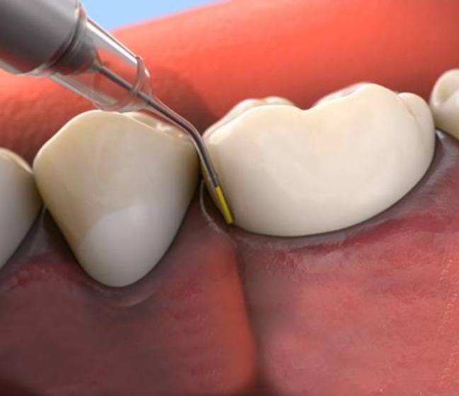 Animated smile during topical antibiotic therapy