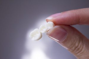 someone holding a dental bridge that has fallen out