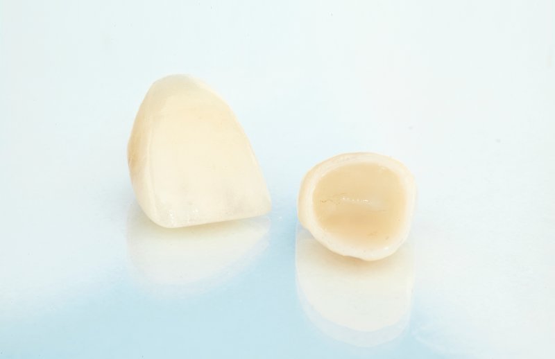 dental crown lying on a table